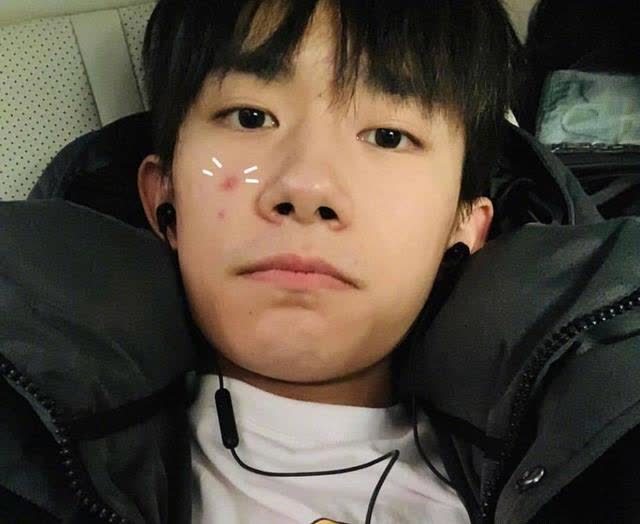 易烊千玺晒男友视角自拍,穿条纹衫素颜出镜,网友:颜值太逆天!