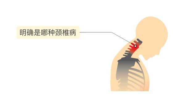 头晕|世纪坛专家：头晕、走路像踩棉花是怎么回事？