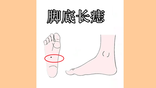 万里挑一的5颗痣颗颗带财一个升官一个生财凤凰命
