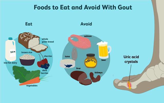 痛风|得了痛风，就啥也不能吃了？不！医生教您三大原则，享用美食不是梦