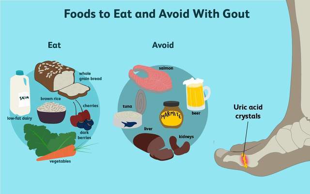 痛风|得了痛风，就啥也不能吃了？不！医生教您三大原则，享用美食不是梦