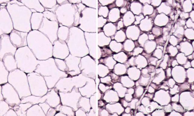 秋裤|不穿秋裤会胖？说反了，寒冷实际上有助于减肥