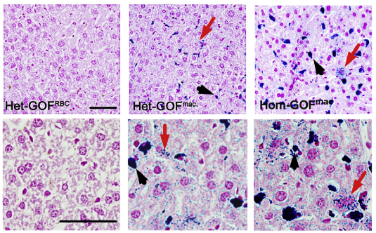 细胞|什么情况下我们体内的铁会升高？原来是这种基因会影响铁水平