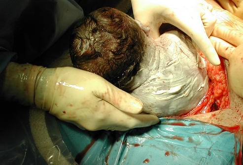 生孩子顺产是最高痛的为什么大多数孕妇能撑过去