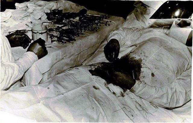 1961年在南极,他突然肚子剧烈疼痛,精通医术的他切开自己的肚子