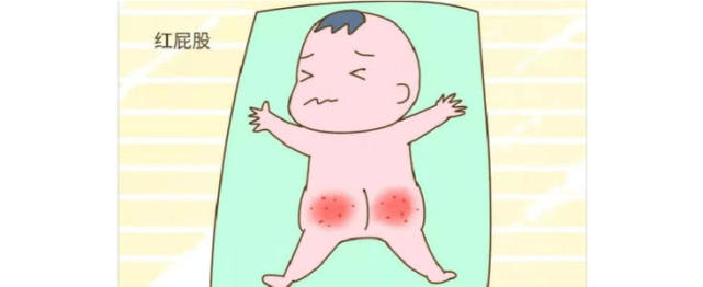 尊素堂育儿科普冬季预防宝宝红屁股这2招要牢记哦
