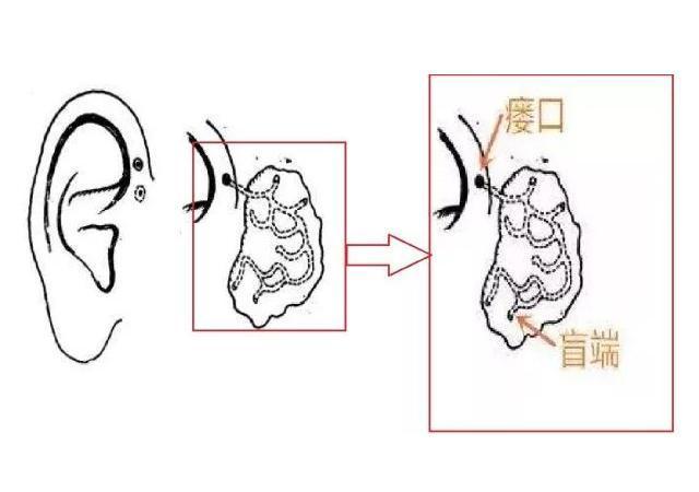 孩子耳朵有一個小孔,不是老人說的有福氣,父母要知道是怎麼回事_騰訊