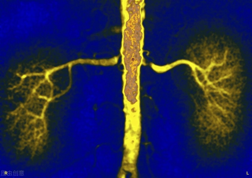 高血压肾病|高血压肾病有什么特点？主要有这5大特征，早发现早治疗