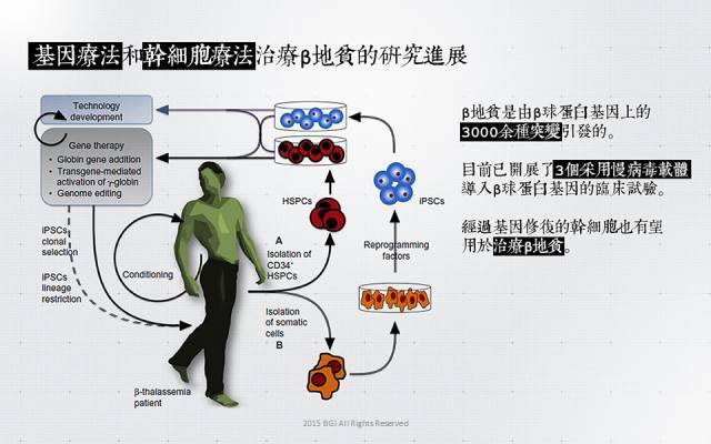 斯蒂芬·威廉·霍金|罕见病并不罕见！这些名人居然都是罕见病患者……