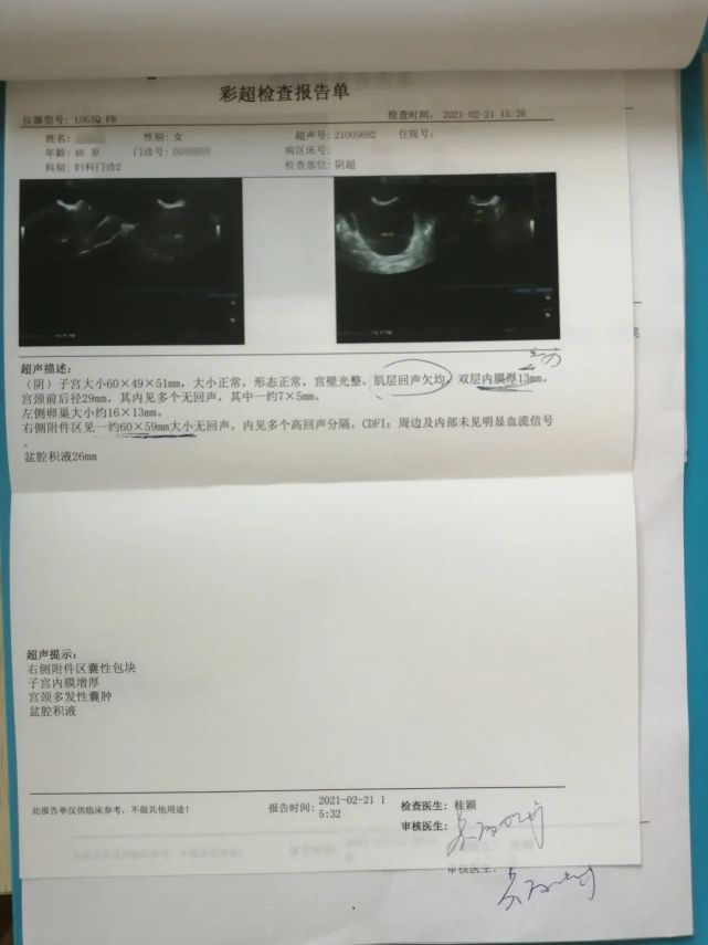 伴隨了2年多的卵巢囊腫,她終於決定手術摘除……|婦科|卵巢囊腫|月經