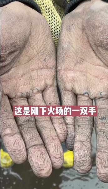 心疼刚下火场消防员的手