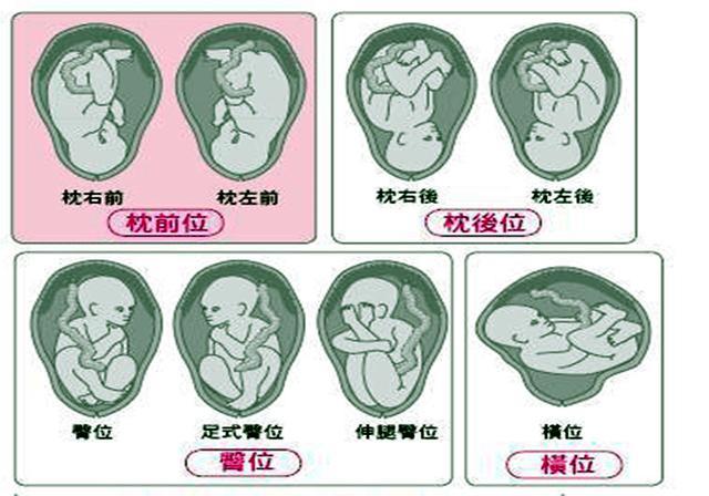 b超单上的这四个字相当于"顺产通行证",拿到的孕妈恭喜了_腾讯新闻