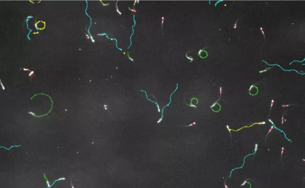 精子|精子像钻头一样旋进，会“毒害”竞争对手，像一场不公平的道具赛