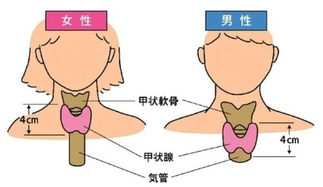 桥本氏甲状腺炎|王克珍：关于桥本氏甲状腺炎你知道多少？