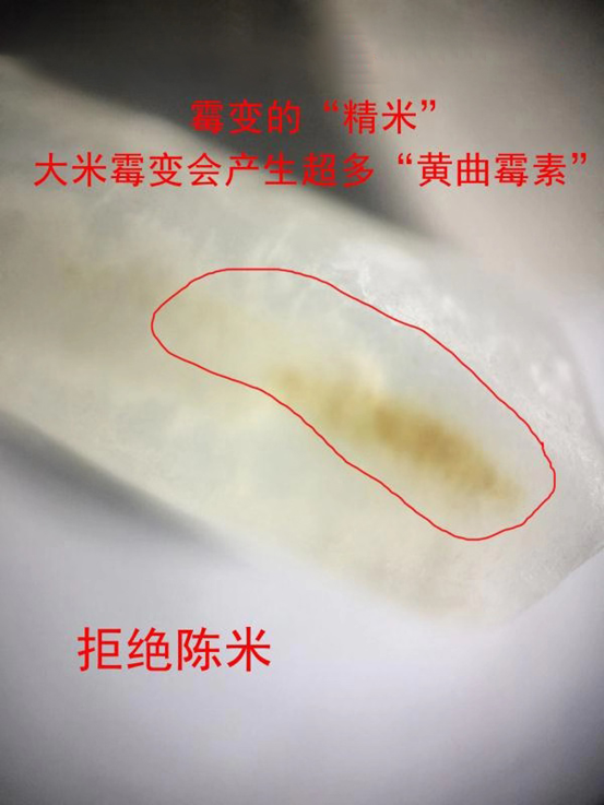 吴孟达远离了我们肝癌的4大诱因其中一种诱因最普遍