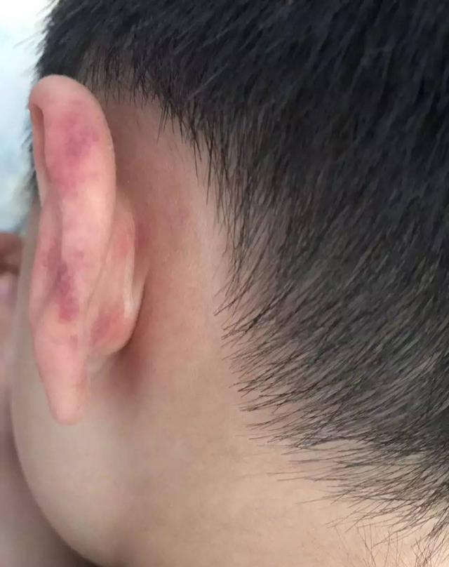 婆婆拧孙子耳朵,宝妈心疼不已,老人教养孩子到底有多难?