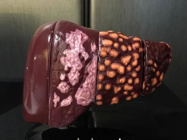 养肝|肝好人长寿，肝坏“眼”先知！养肝三部曲，帮你拥有“长寿肝”