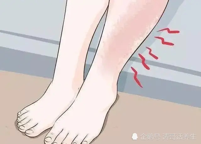 下肢水肿真的有那么可怕吗?