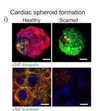 水凝胶|Nature｜通过自愈水凝胶中球体融合实现高细胞密度3D生物打印