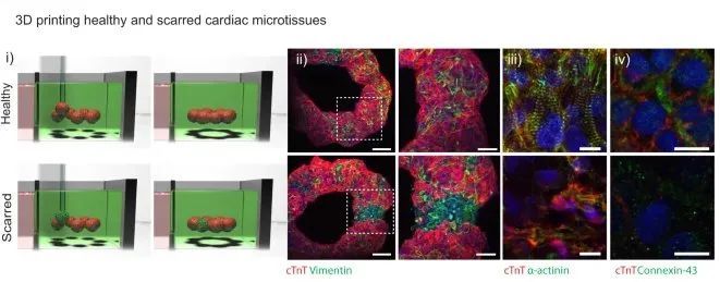 水凝胶|Nature｜通过自愈水凝胶中球体融合实现高细胞密度3D生物打印