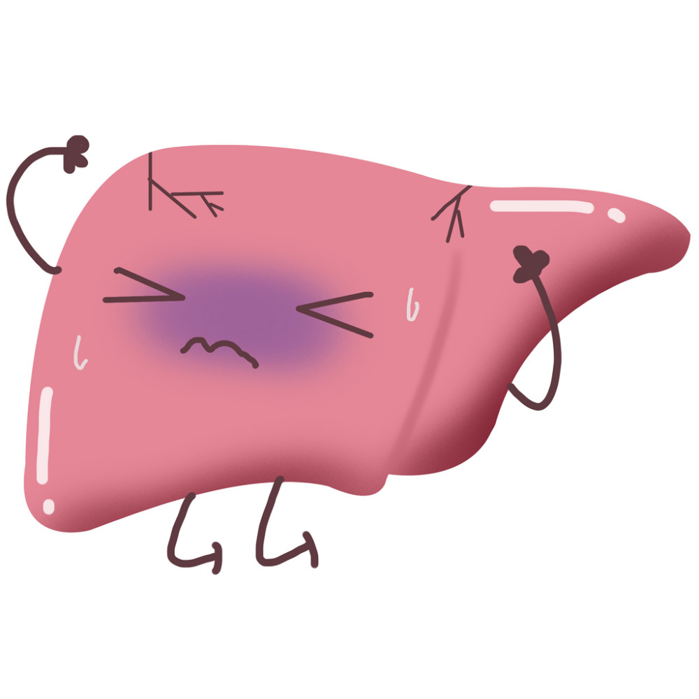轻度脂肪肝|轻度脂肪肝很常见，不需要看医生？最好到医院检查