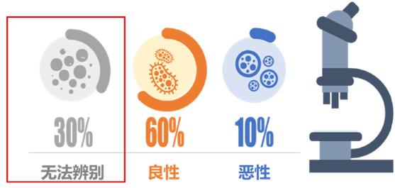 西湖大学|西湖大学新转化项目获数千万元种子轮融资，助甲状腺结节诊断