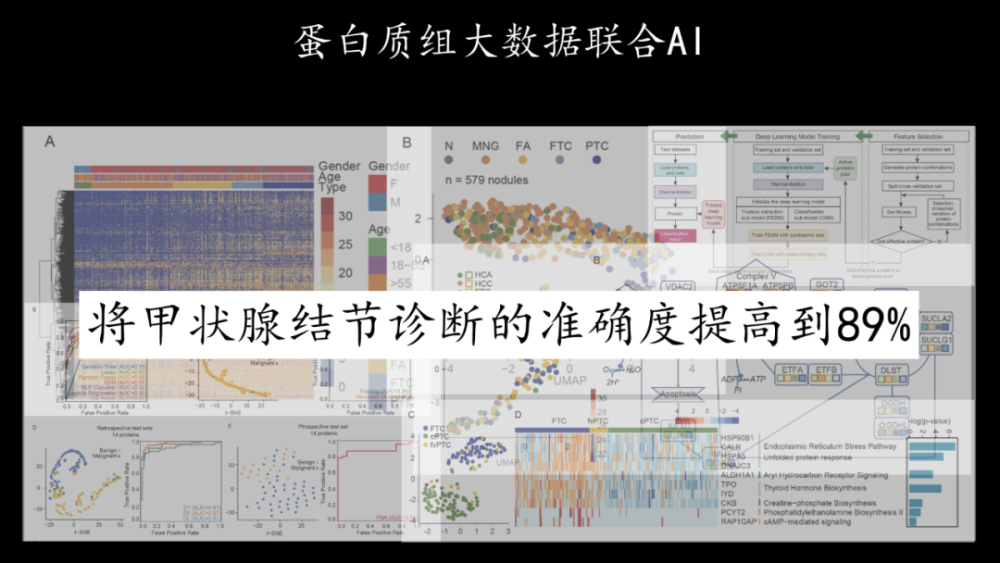 西湖大学|西湖大学新转化项目获数千万元种子轮融资，助甲状腺结节诊断