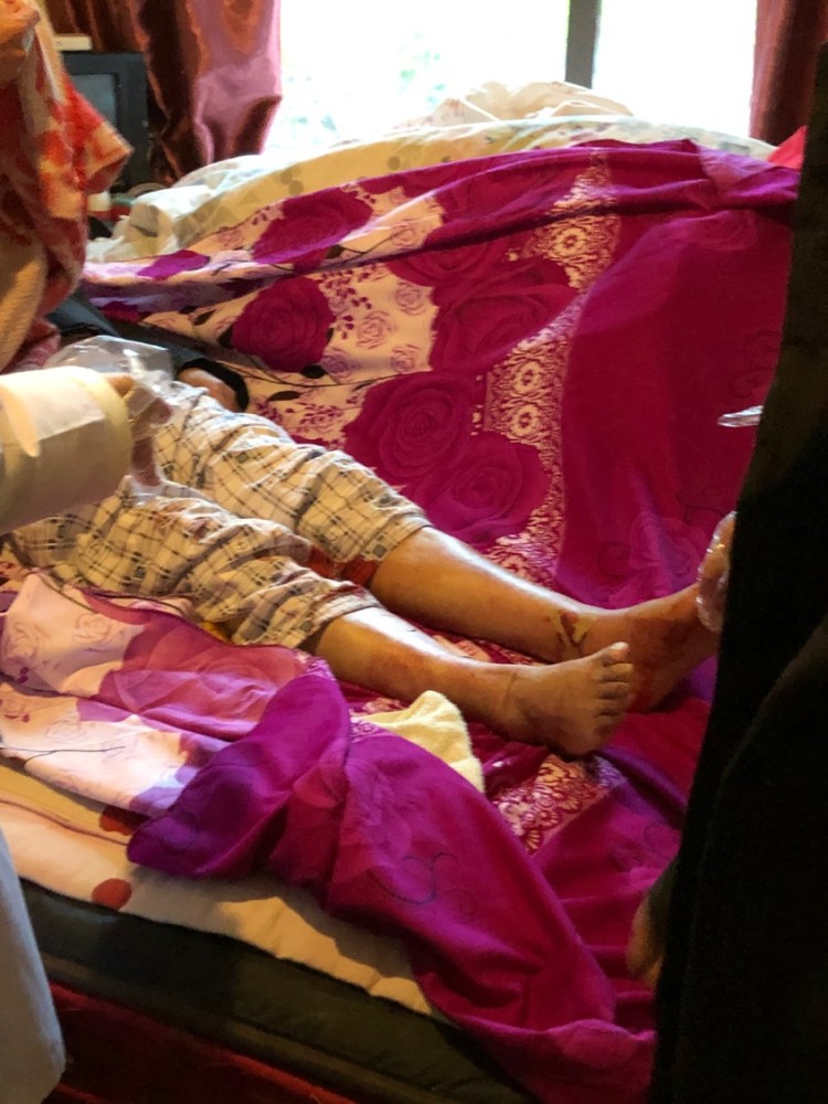 乐山一8旬老人家中如厕两次摔倒,医生提醒