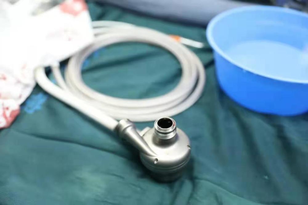 心室|浙江首例“人工心脏”植入术成功：金属血液泵替代左心室