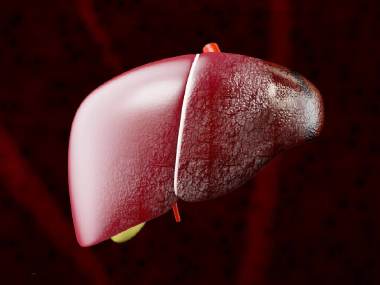 甲胎蛋白|52岁民工，甲胎蛋白过高，肝科主任：常吃一物，肝逐渐柔软