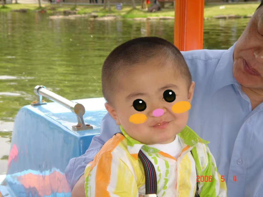 和罕见病抗争的第13年黏多糖贮积症ii型患者家属的期盼