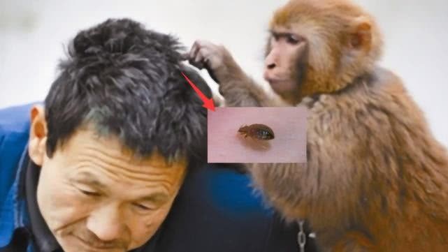 虱子|明明很干净，为什么还会长虱子？什么样的人容易感染虱子？