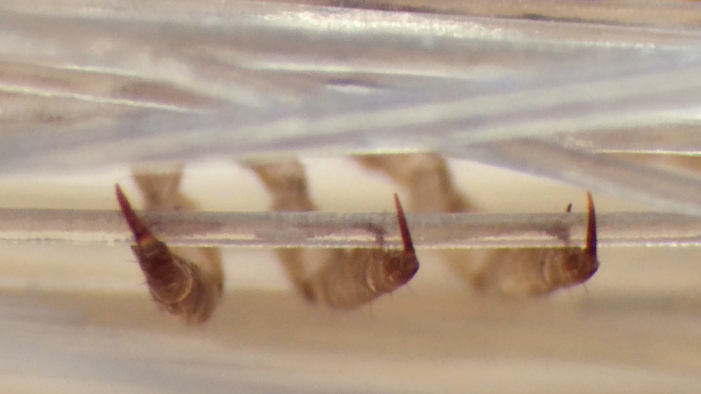 虱子|明明很干净，为什么还会长虱子？什么样的人容易感染虱子？