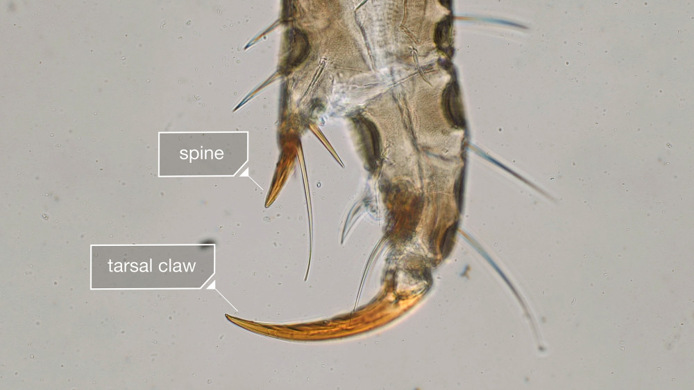 虱子|明明很干净，为什么还会长虱子？什么样的人容易感染虱子？