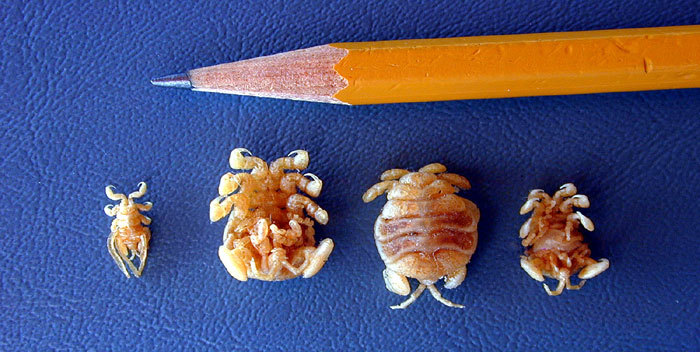 虱子|明明很干净，为什么还会长虱子？什么样的人容易感染虱子？