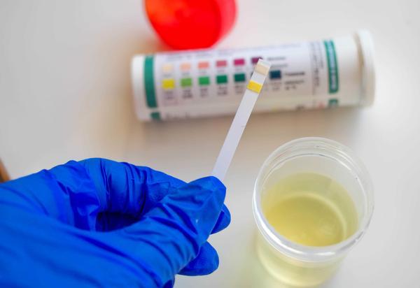 尿液|尿液里原来藏有“健康信号”，小便后低头看看，对照一下