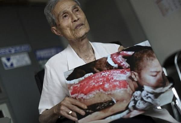 日本核爆幸存者图片
