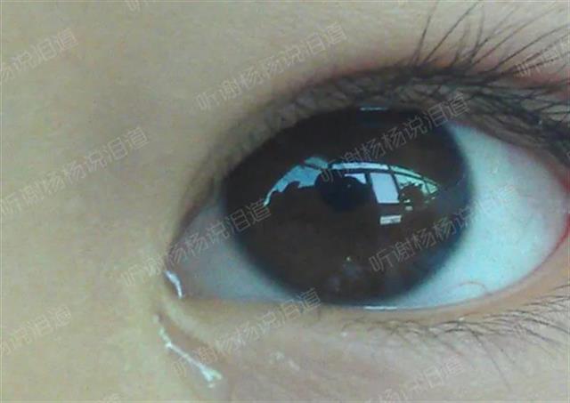 家住黄冈的君君,从一出生就比别人更爱哭,眼角总会时不时的挂几滴泪水