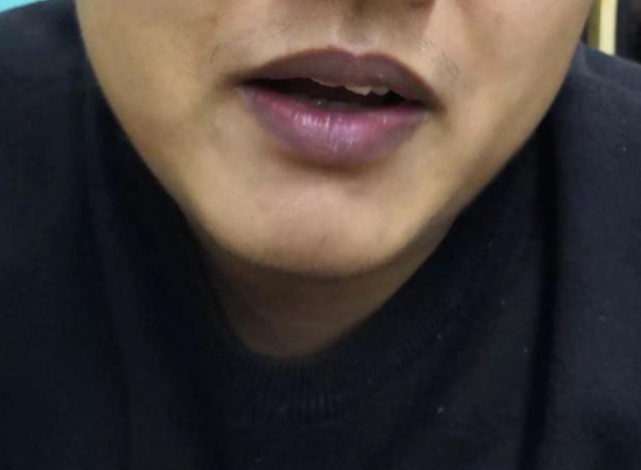 正常人的嘴唇应该是红润的.