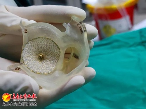 房颤|新疆首例3D打印指导下的心脏介入“一站式”手术成功