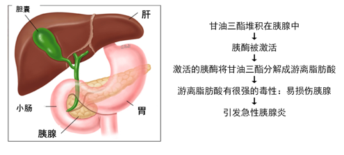 高甘油三酯血症|浙江男子吃了一顿烧烤夜宵，血液变成金黄色！