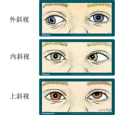 太可怕了歪头看东西原因竟是