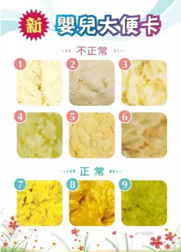 宝宝大便的频率并不是固定的,一般在每天2次~每2天1次,也有的宝宝每天