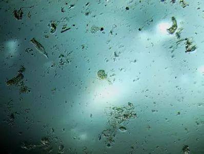 下面这张图是自来水在显微镜下放大40倍的照片.