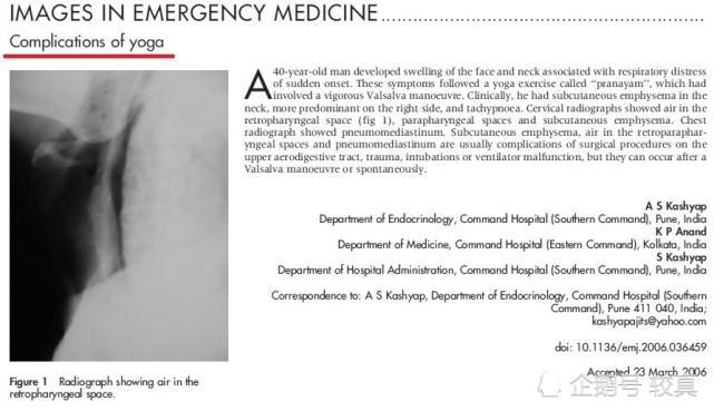 瑜伽|对瑜伽的捧与杀都别妖魔化，一文读懂瑜伽优缺点