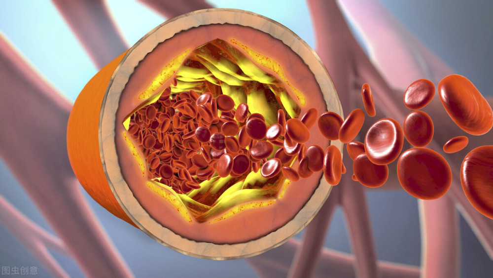 血管|血管不好，从头伤到脚？不是危言耸听，这几处会“遭殃”