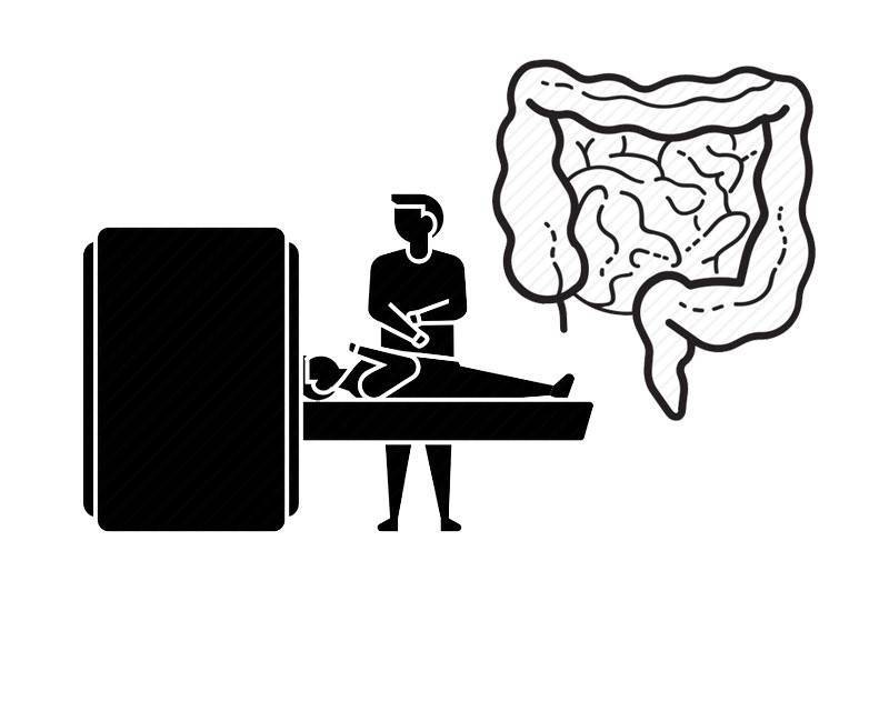 大肠癌|超9成大肠癌源于息肉癌变？要想远离大肠癌，体检时别漏了这3项