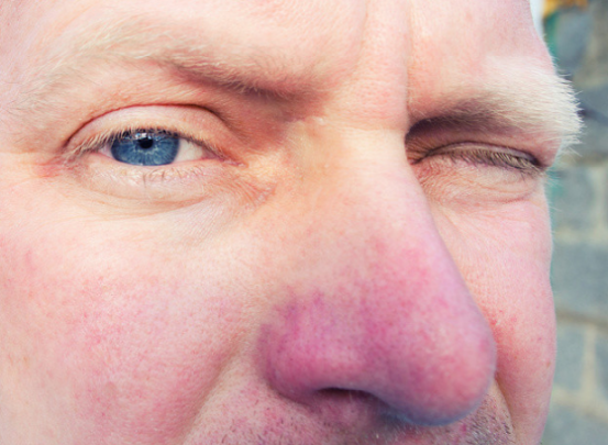 "黄金配角"吴孟达肝癌离世,提醒:这5类人,建议坚持养肝