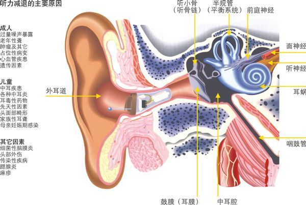 听力受损|全球1/5的人听力已受损，经常做这4种事情的人群，是时候该注意了