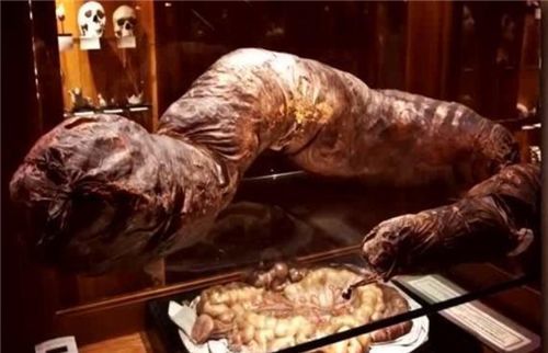 5米的长度,而约翰的大肠硬是被粪便挤胀到了1.8米.